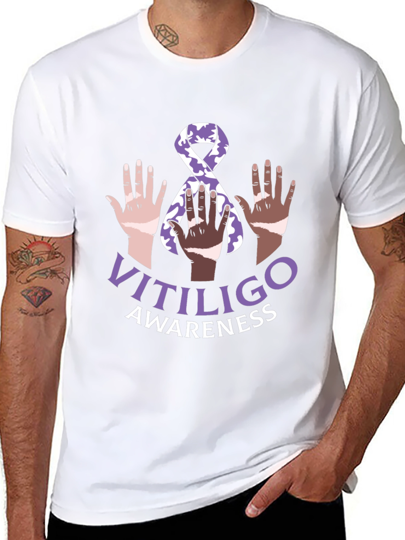 Vitiligo Awareness T-Shirt