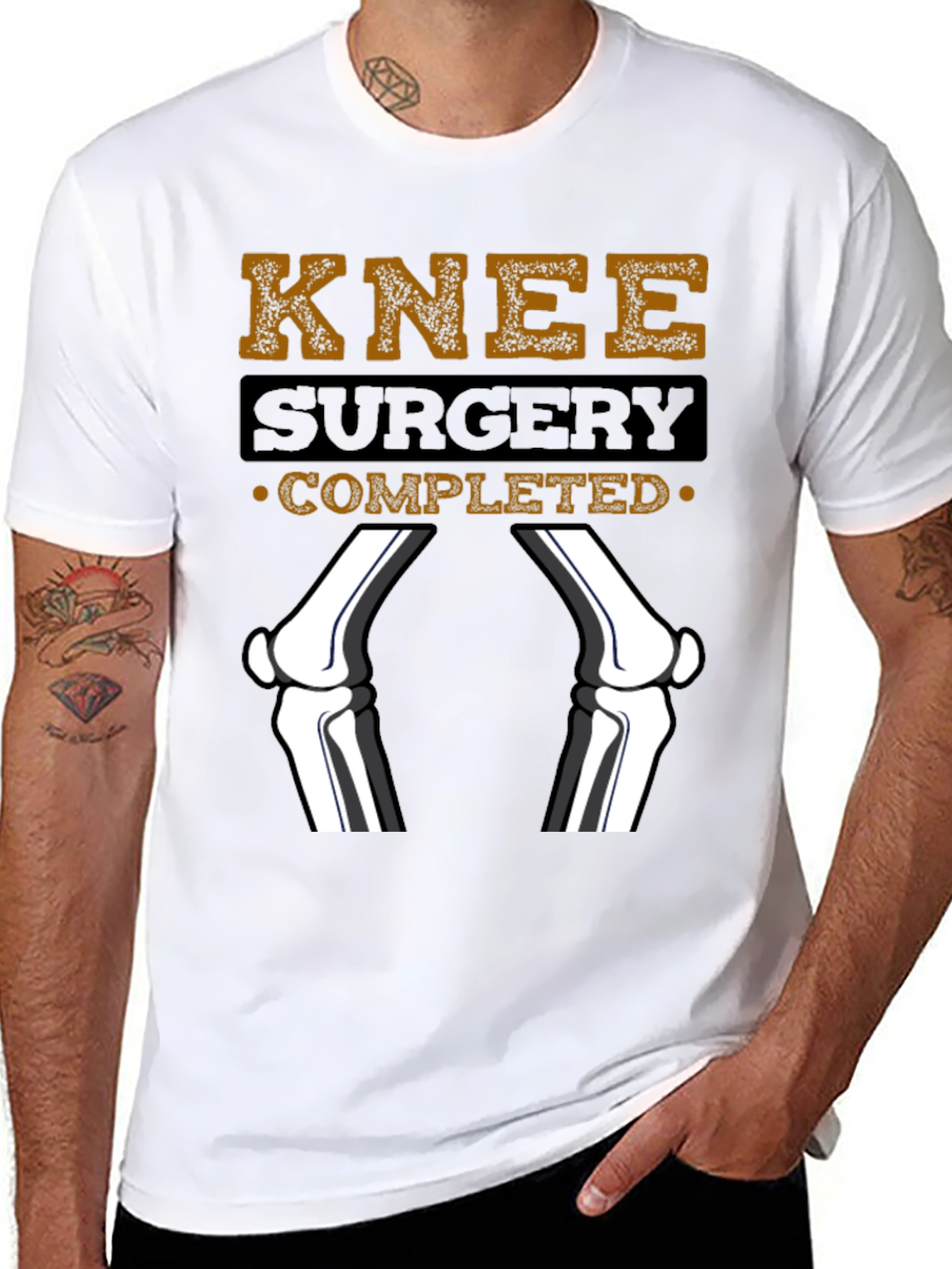 Knee Surgery Completed Graphic T-Shirt